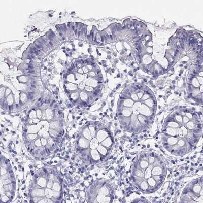 Immunohistochemistry-Paraffin: TSH beta Antibody [NBP2-68647]