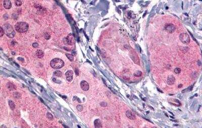 Immunohistochemistry-Paraffin: TSHR Antibody - BSA Free [NLS1449]