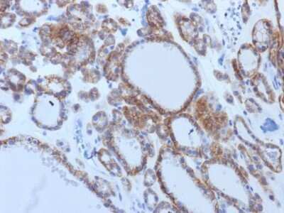 Immunohistochemistry-Paraffin: TSHR Antibody (TSHRB/1405) [NBP2-53223]