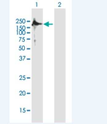 Western Blot: TSHZ2 Antibody [H00128553-B01P-50ug]