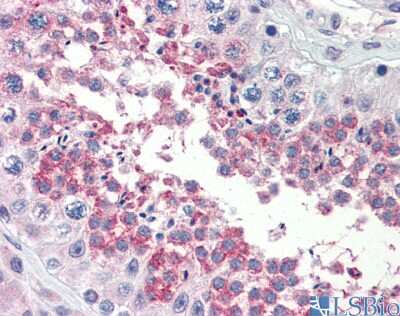 Immunohistochemistry: TSKS Antibody [NBP1-54878]