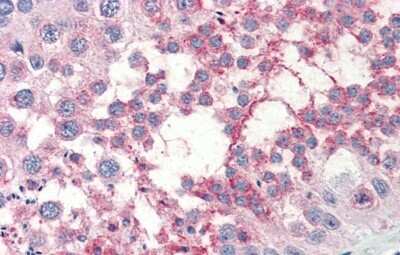 Immunohistochemistry-Paraffin: TSKS Antibody [NBP1-54878]