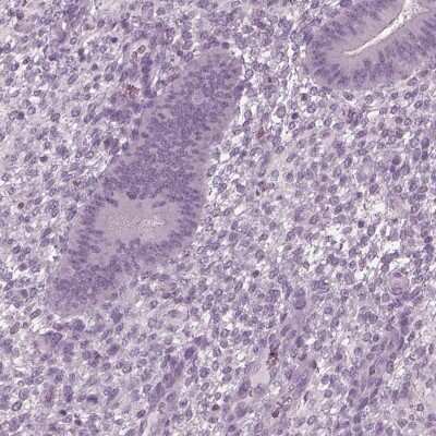 Immunohistochemistry-Paraffin: TSKS Antibody [NBP1-92539]