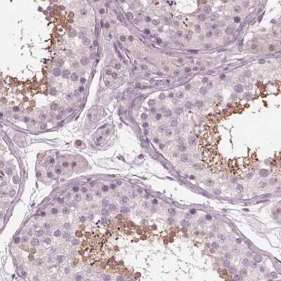 Immunohistochemistry-Paraffin: TSKS Antibody [NBP1-92539]