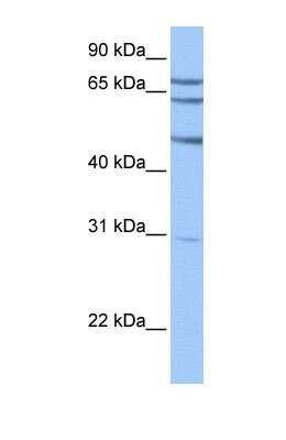 Western Blot: TSKS Antibody [NBP1-54878]