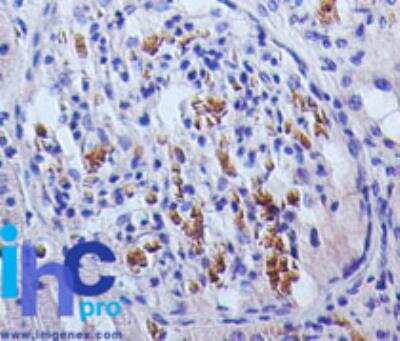 Immunohistochemistry-Paraffin: TSLP Antibody (55N2D4) - BSA Free [NBP2-27325]