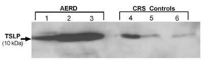 Western Blot: TSLP AntibodyBSA Free [NB110-55234]
