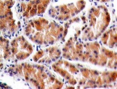 Immunohistochemistry-Paraffin: TSLPR/CRLF2 Antibody (59N5G4) [NBP2-27331]