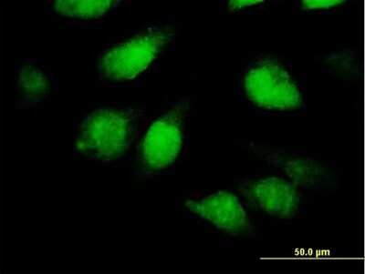 Immunocytochemistry/ Immunofluorescence: TSNAXIP1 Antibody [H00055815-B01P]