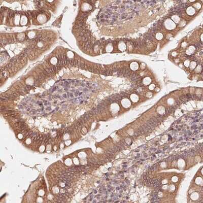 Immunohistochemistry-Paraffin: TSPAN12 Antibody [NBP2-49278]