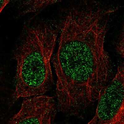 Immunocytochemistry/ Immunofluorescence: TSPAN13 Antibody [NBP1-81001]