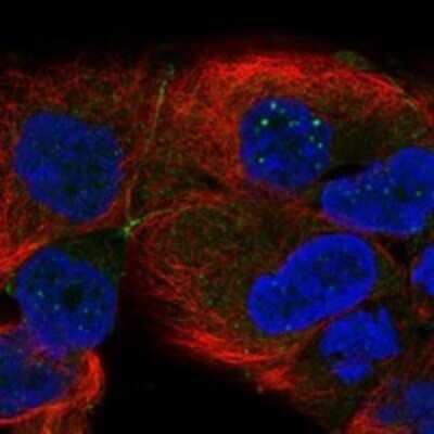 Immunocytochemistry/ Immunofluorescence: TSPAN15 Antibody [NBP3-17323]