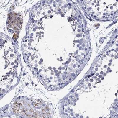 Immunohistochemistry-Paraffin: TSPAN16 Antibody [NBP3-16969]