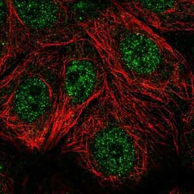 Immunocytochemistry/ Immunofluorescence: TSPAN17 Antibody [NBP2-57551]