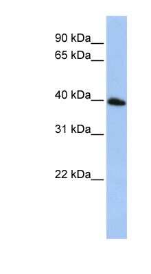 Western Blot: TSPAN17 Antibody [NBP1-59770]