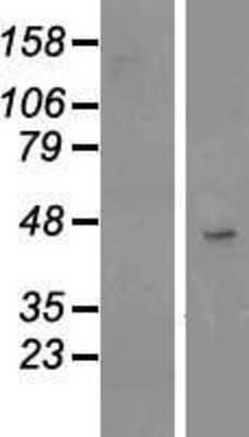 Western Blot: TSPAN17 Overexpression Lysate [NBL1-17370]