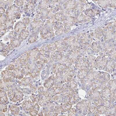 Immunohistochemistry: TSPAN19 Antibody [NBP2-34151]