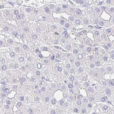 Immunohistochemistry: TSPAN19 Antibody [NBP2-34151]