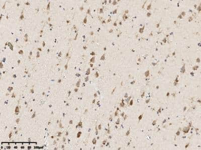 Immunohistochemistry: TSPAN3 Antibody [NBP3-14797]