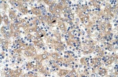 Immunohistochemistry-Paraffin: TSPAN32/TSSC6 Antibody [NBP1-62646]