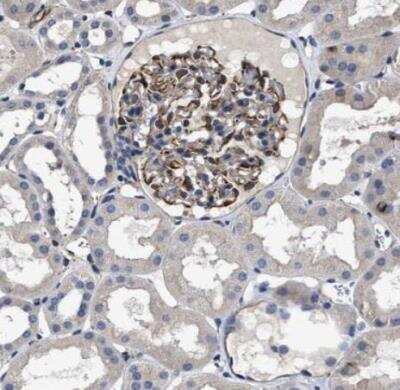 Immunohistochemistry-Paraffin: TSPAN33 Antibody [NBP1-92490]