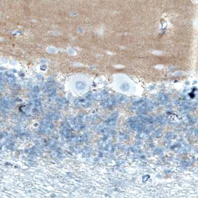 Immunohistochemistry-Paraffin: TSPAN7/TM4SF2 Antibody (CL0265) [NBP2-52895]