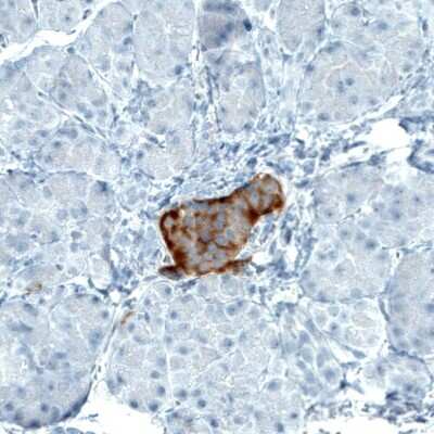 Immunohistochemistry-Paraffin: TSPAN7/TM4SF2 Antibody (CL0265) [NBP2-52895]