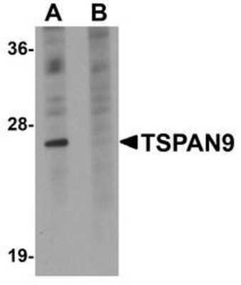 Western Blot: TSPAN9 AntibodyBSA Free [NBP1-77098]