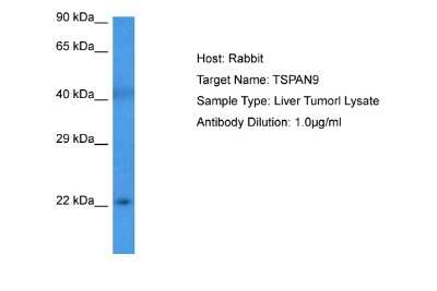 Western Blot: TSPAN9 Antibody [NBP2-88504]