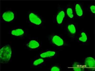 Immunocytochemistry/ Immunofluorescence: TSPYL1 Antibody (4F11) [H00007259-M01]