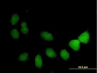 Immunocytochemistry/ Immunofluorescence: TSPYL4 Antibody [H00023270-B01P]