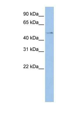 Western Blot: TSPYL4 Antibody [NBP1-56289]