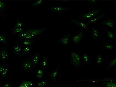 Immunocytochemistry/ Immunofluorescence: TSPYL6 Antibody [H00388951-B01P]