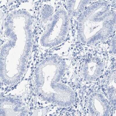 Immunohistochemistry-Paraffin: TSPYL6 Antibody [NBP1-85917]