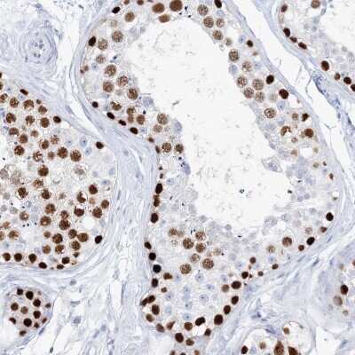 Immunohistochemistry-Paraffin: TSPYL6 Antibody [NBP1-85917]