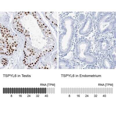 Immunohistochemistry-Paraffin: TSPYL6 Antibody [NBP1-85917]
