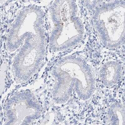 Immunohistochemistry-Paraffin: TSPYL6 Antibody [NBP2-33977]