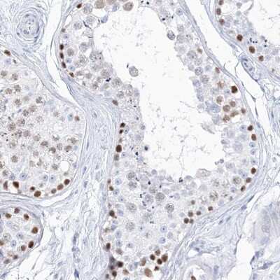 Immunohistochemistry-Paraffin: TSPYL6 Antibody [NBP2-33977]