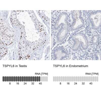 Immunohistochemistry-Paraffin: TSPYL6 Antibody [NBP2-33977]