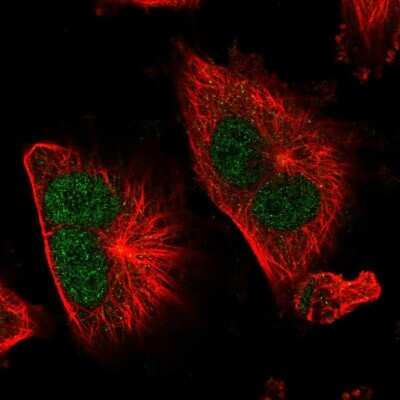 Immunocytochemistry/ Immunofluorescence: TSR1 Antibody [NBP2-58300]