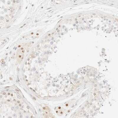 Immunohistochemistry-Paraffin: TSR1 Antibody [NBP1-84619]