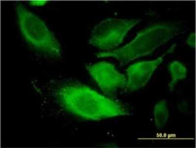 Immunocytochemistry/ Immunofluorescence: TSSC1 Antibody (2H5) [H00007260-M01]