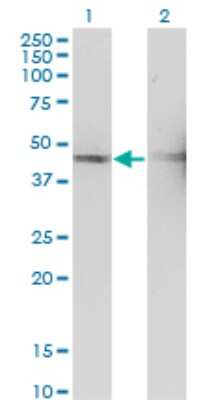 Western Blot: TSSC1 Antibody (2H5) [H00007260-M01]