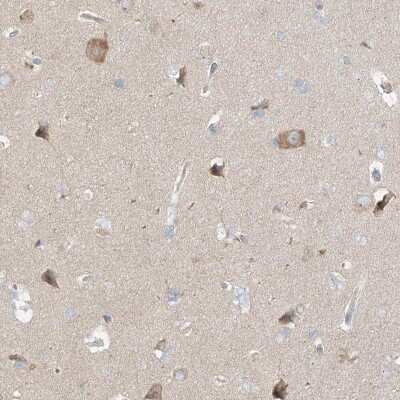 Immunohistochemistry-Paraffin: TSSC1 Antibody [NBP1-85927]