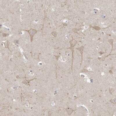 Immunohistochemistry-Paraffin: TSSC1 Antibody [NBP1-86332]