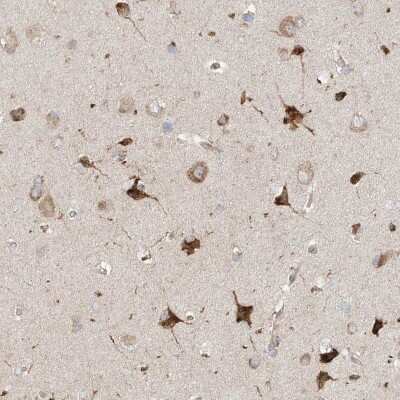 Immunohistochemistry-Paraffin: TSSC1 Antibody [NBP1-86333]