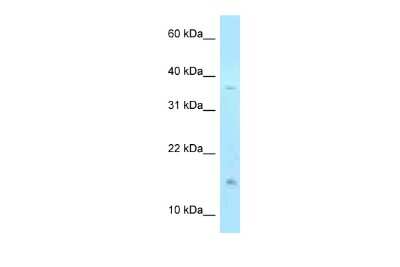 Western Blot: TSSC3 Antibody [NBP2-82367]