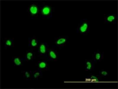 Immunocytochemistry/ Immunofluorescence: TSSK1 Antibody (2E8) [H00083942-M02]