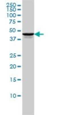 Western Blot: TSSK2 Antibody (1E12) [H00023617-M01]