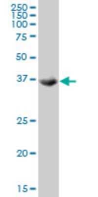 Western Blot: TSSK2 Antibody (1F6) [H00023617-M03]